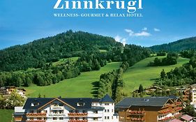 Zinnkruegl Alpendorf (salzburg)